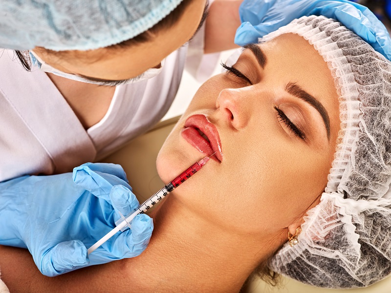 Dermal Fillers