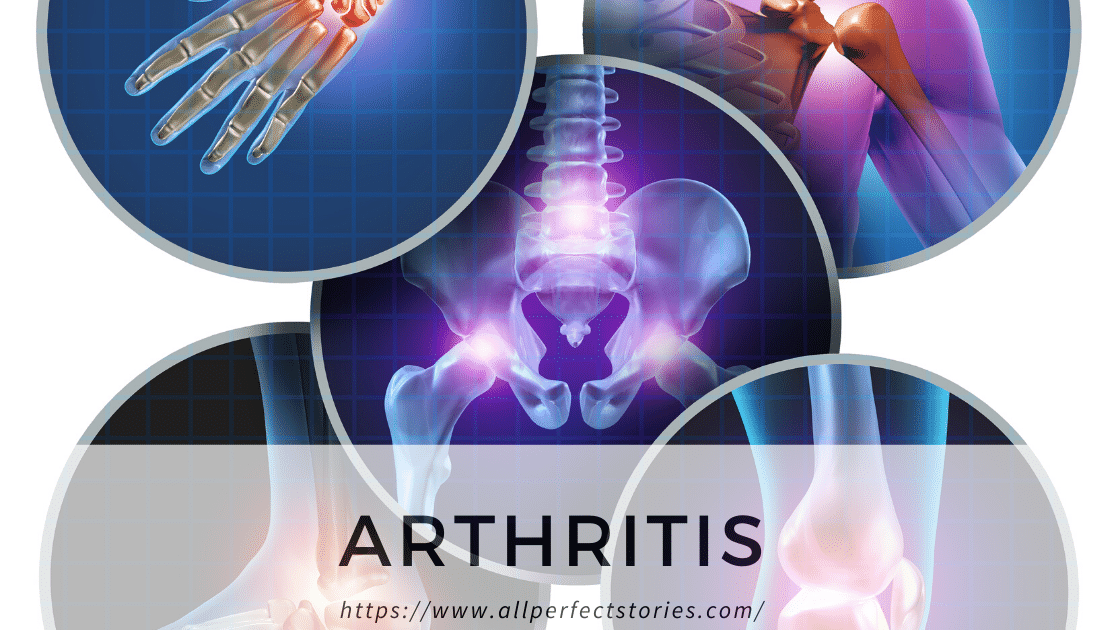 Arthritis