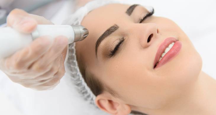 Laser Resurfacing Treatment