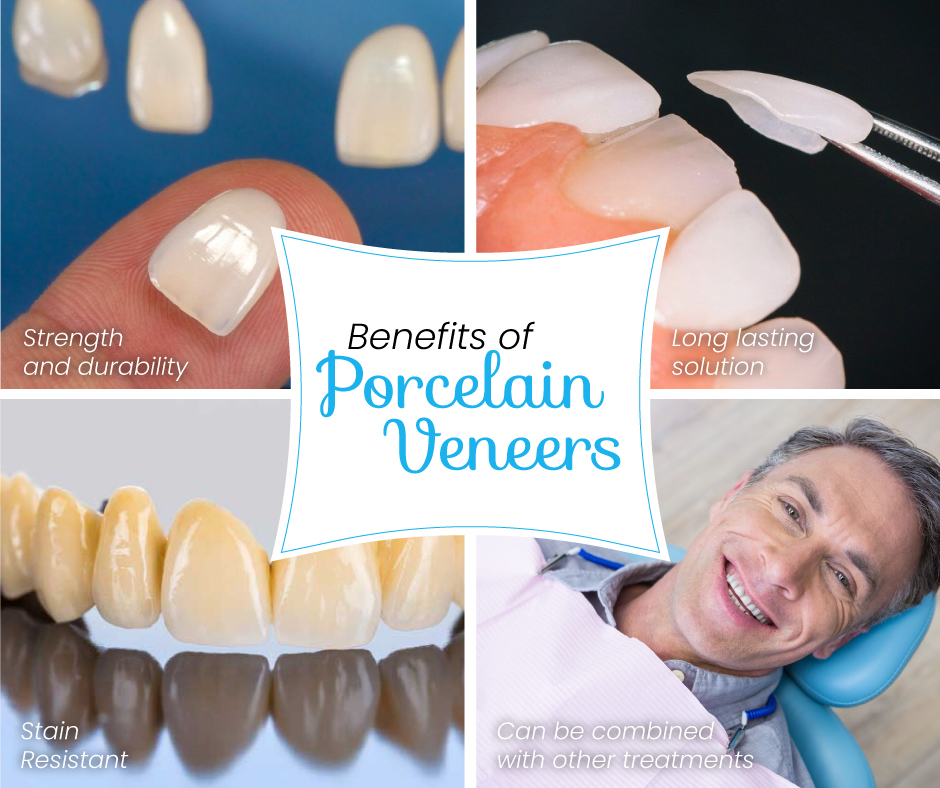 Porcelain Veneers