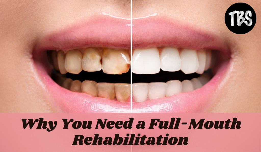 Mouth Rehabilitation