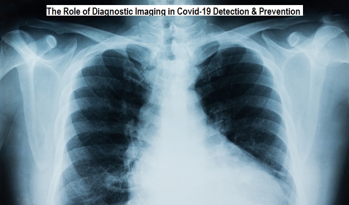 Diagnostic Imaging in Covid-19