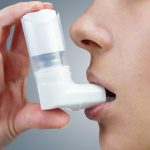 asthmas