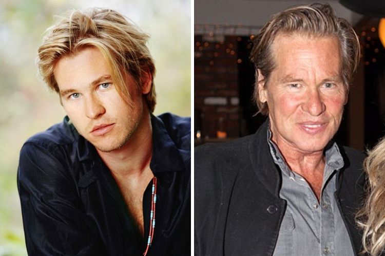 Val Kilmer health