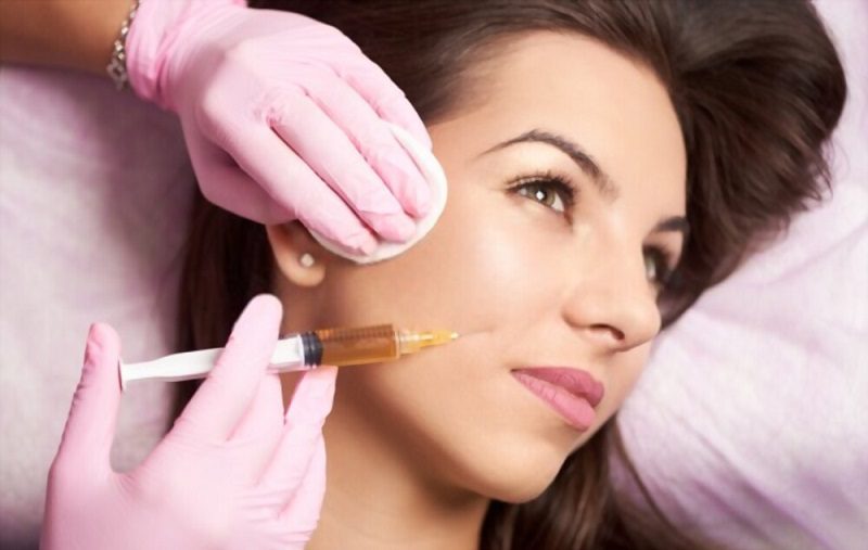 dermal fillers