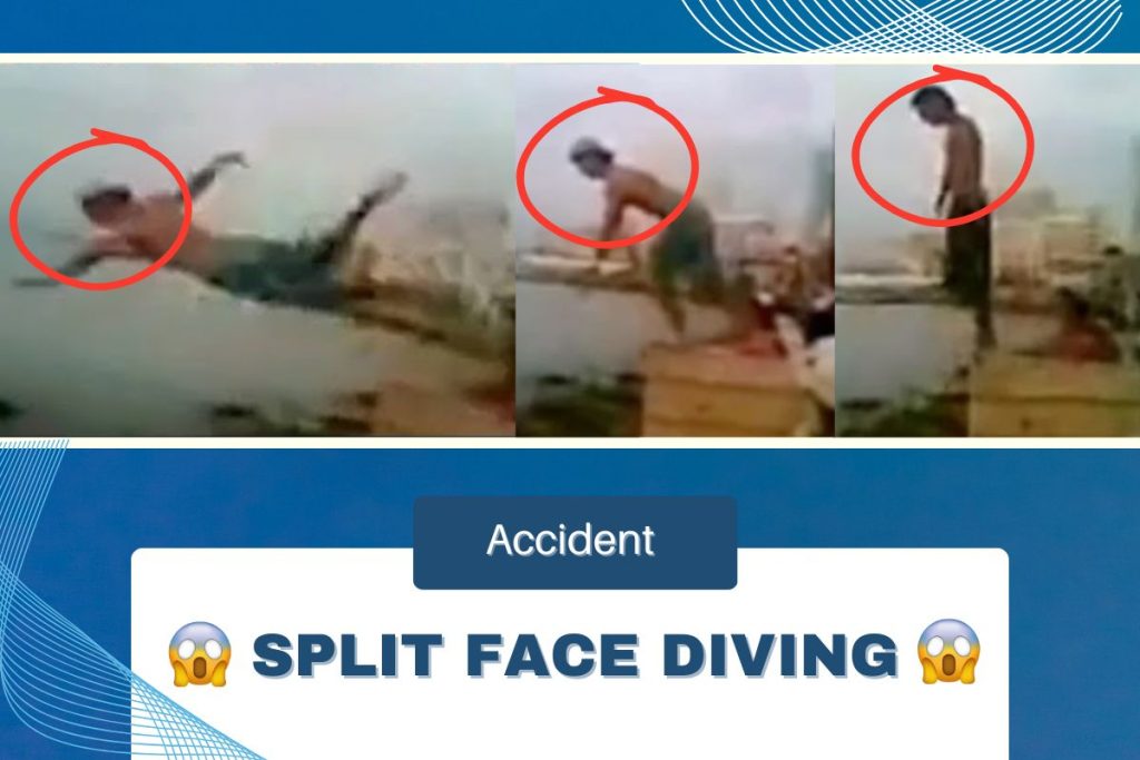 Exploring the Shocking Incident – Split Face Diving Accident