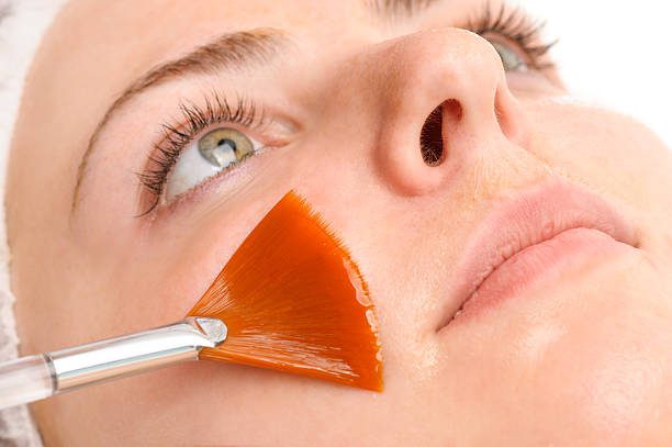 Chemical Peels Decoded