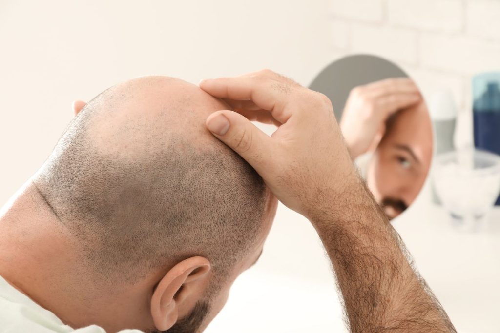 Hair Transplant Clinic