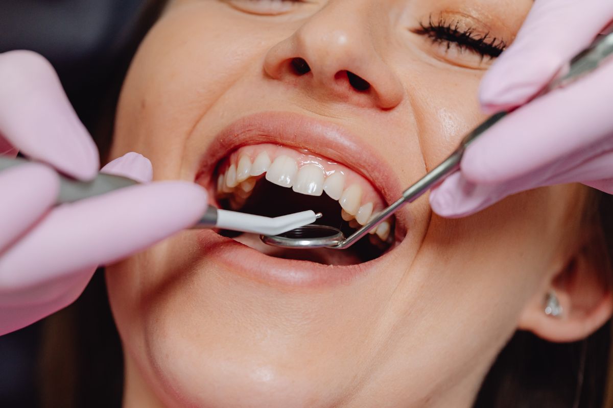 fixed full arch dental implant