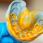 Dental Impressions