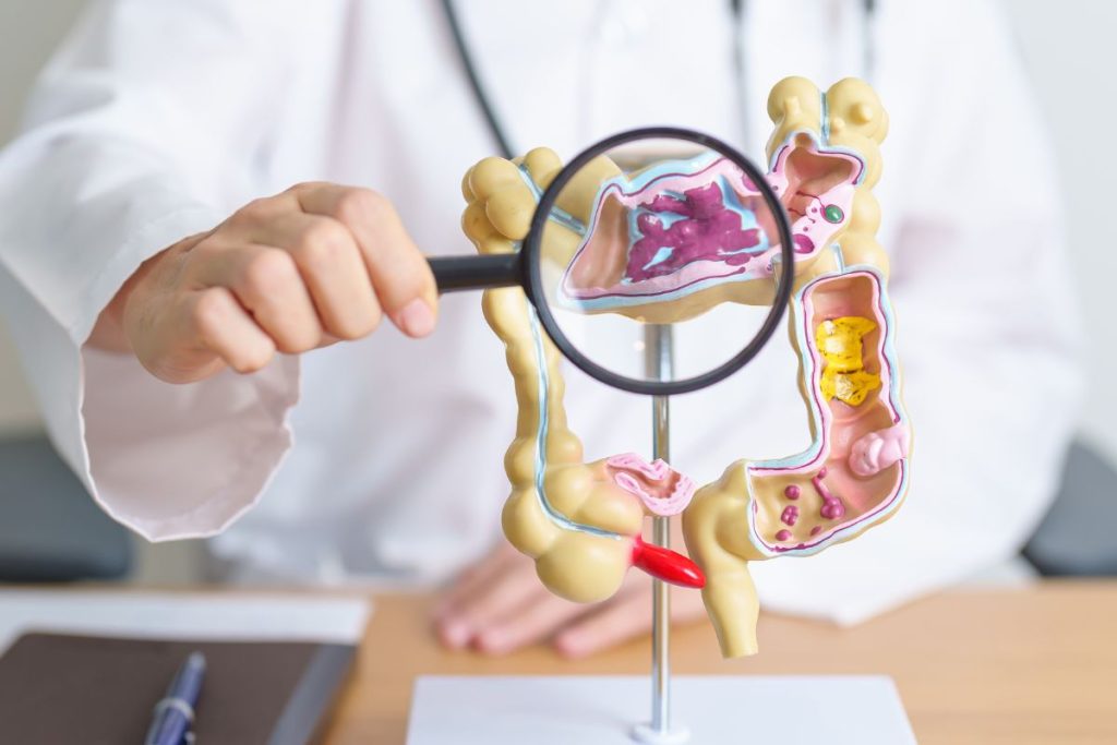What is Colon Cancer