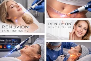 Renuvion Skin Tightening